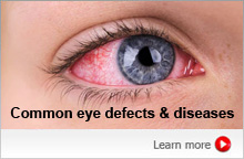 Eye defects & diseases